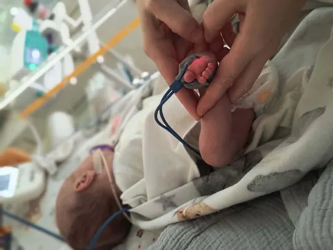 1700 грамів надії: як львівські лікарі врятували немовля з Тернополя